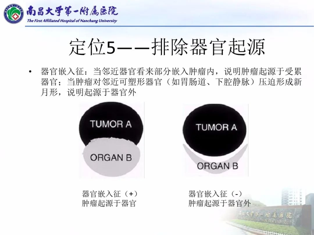 影像PPT - 【PPT】常见腹膜后肿瘤的诊断及鉴别诊断-74