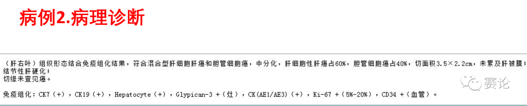 影像PPT - 肝内胆管细胞癌影像学诊断及鉴别诊断-10 影像PPT - 肝内胆管细胞癌影像学诊断及鉴别诊断-10