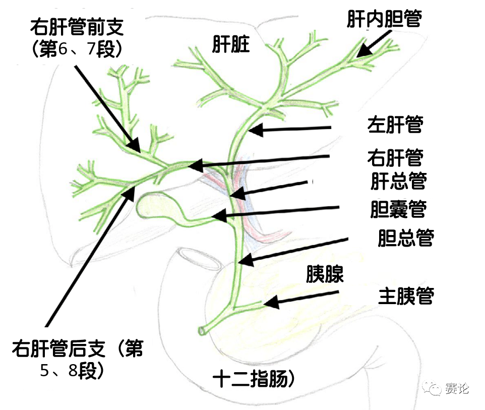 影像PPT - 肝内胆管细胞癌影像学诊断及鉴别诊断-18 影像PPT - 肝内胆管细胞癌影像学诊断及鉴别诊断-18