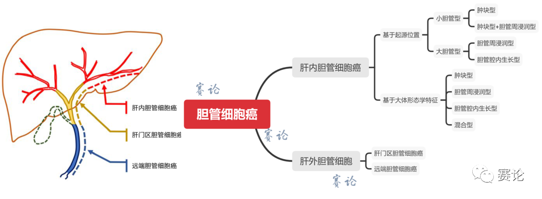 影像PPT - 肝内胆管细胞癌影像学诊断及鉴别诊断-28 影像PPT - 肝内胆管细胞癌影像学诊断及鉴别诊断-28