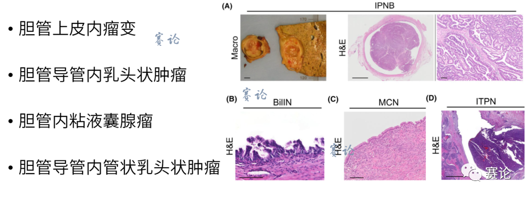 影像PPT - 肝内胆管细胞癌影像学诊断及鉴别诊断-33 影像PPT - 肝内胆管细胞癌影像学诊断及鉴别诊断-33