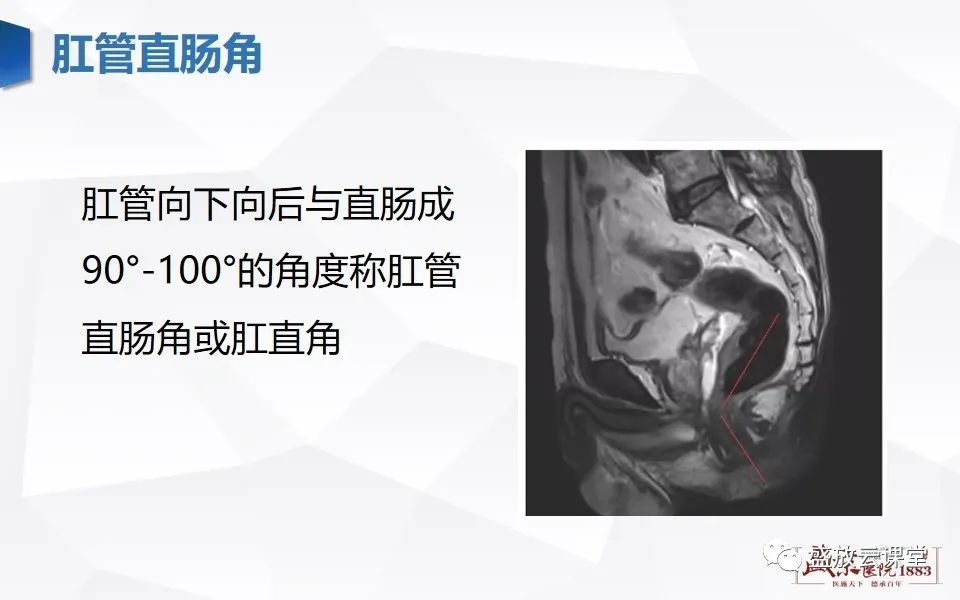 影像PPT - 【PPT】直肠癌术前MR分期-6