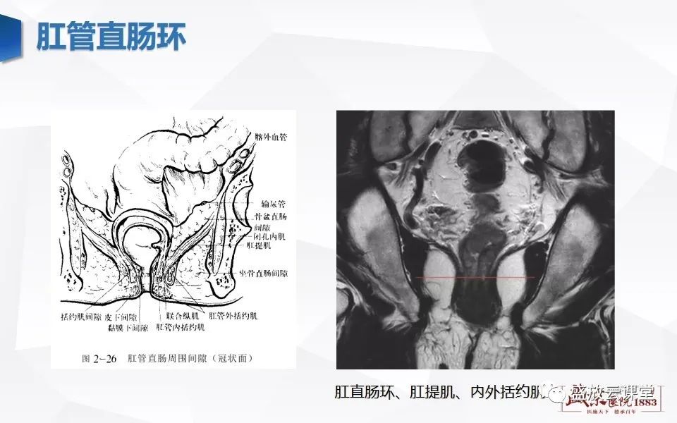 影像PPT - 【PPT】直肠癌术前MR分期-8