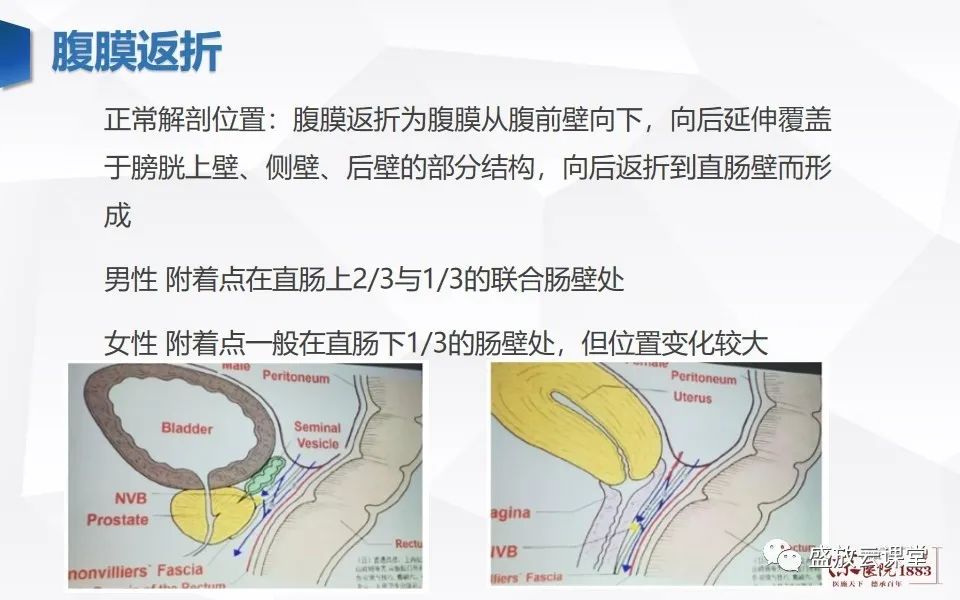 影像PPT - 【PPT】直肠癌术前MR分期-9