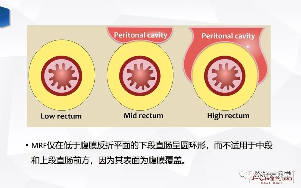 影像PPT - 【PPT】直肠癌术前MR分期-12