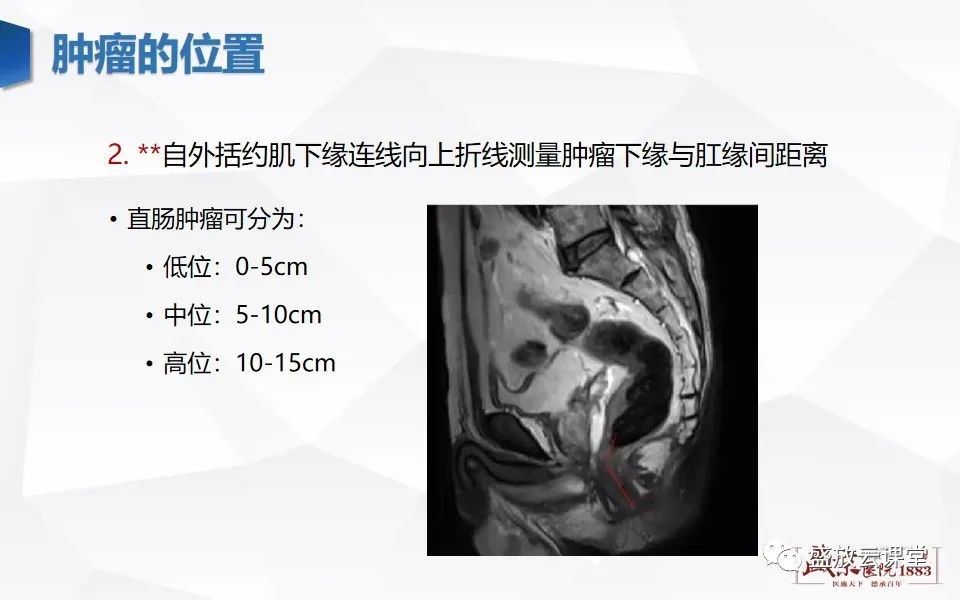 影像PPT - 【PPT】直肠癌术前MR分期-20