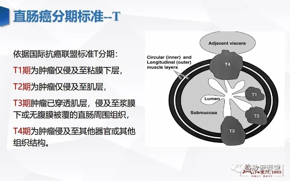 影像PPT - 【PPT】直肠癌术前MR分期-21