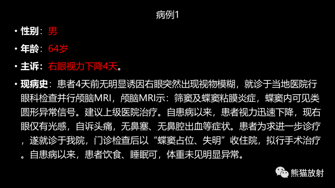 影像PPT - 【病例】鼻窦癌 VS 颅面骨骨化性纤维瘤-2