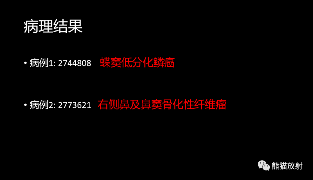 影像PPT - 【病例】鼻窦癌 VS 颅面骨骨化性纤维瘤-21