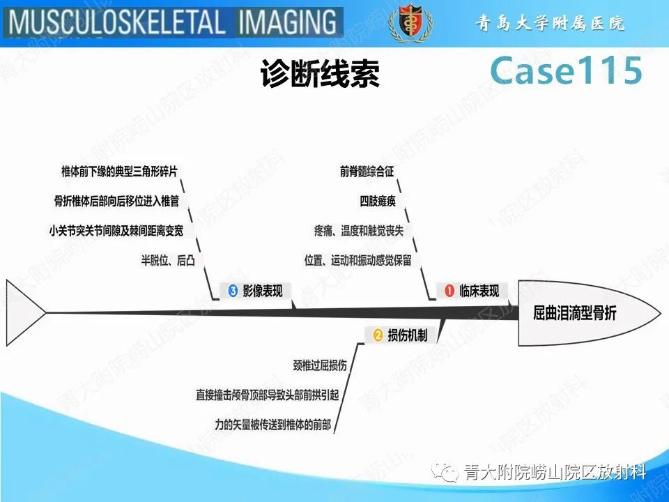 影像PPT - 【PPT】屈曲泪滴型骨折-22