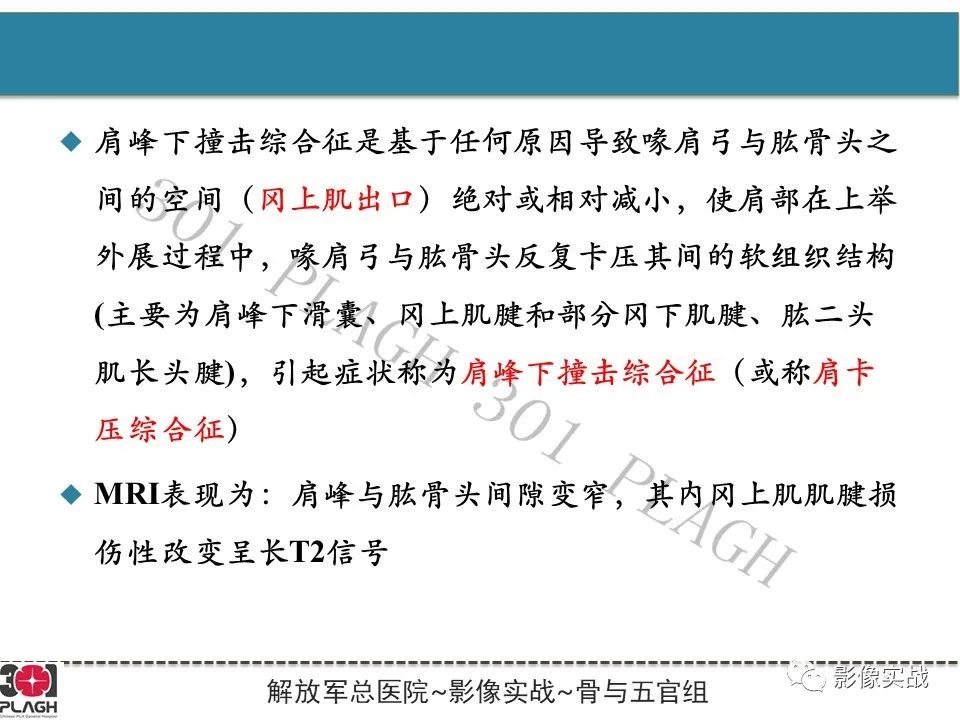 影像PPT - 【PPT】肩峰下撞击综合征-5