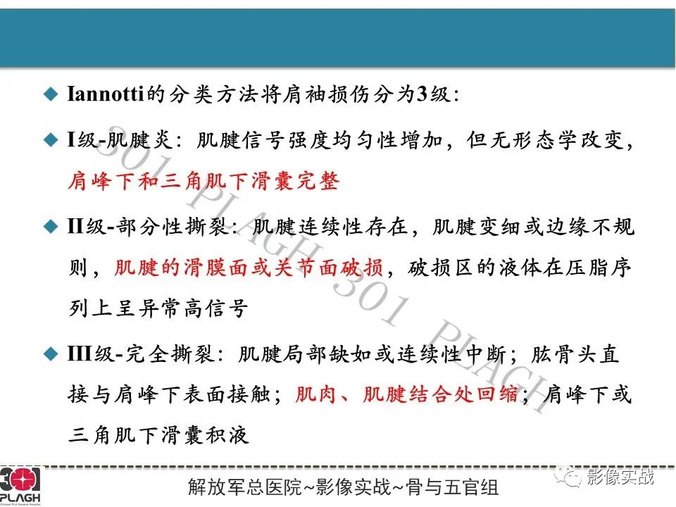 影像PPT - 【PPT】肩峰下撞击综合征-6