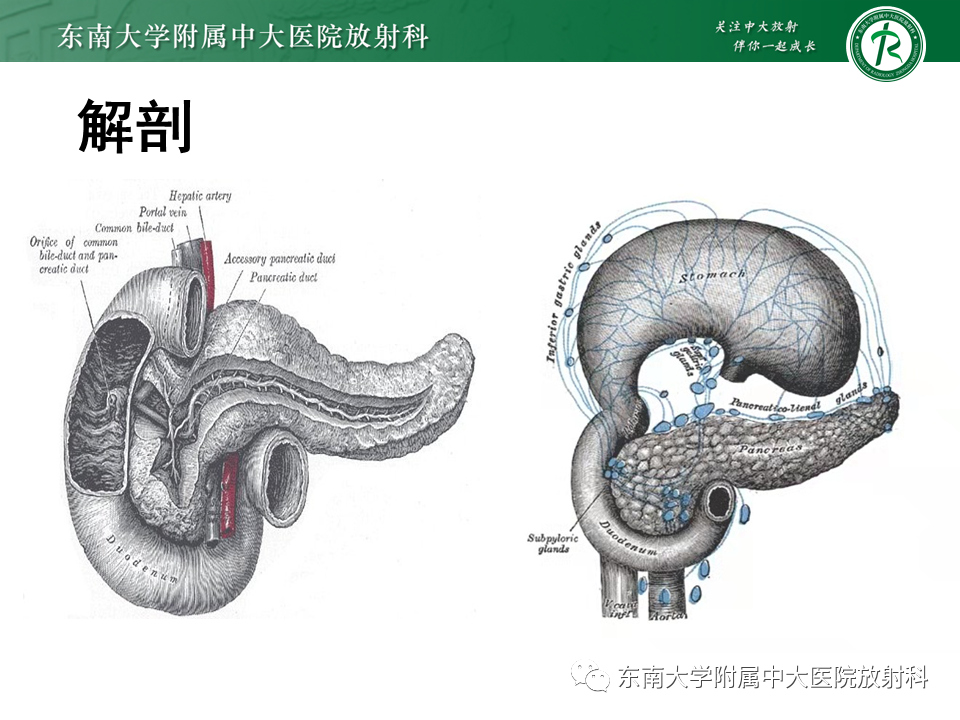 影像PPT - 【PPT】胰腺癌影像诊断及鉴别诊断-5