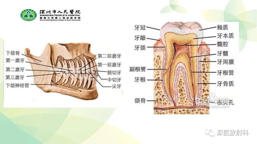 影像PPT - 【PPT】颌骨病变的影像表现-5