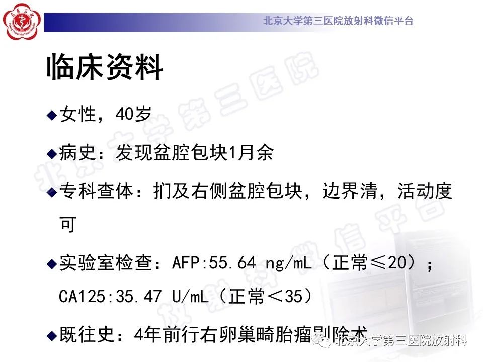 影像PPT - 【PPT】卵巢未成熟畸胎瘤-2