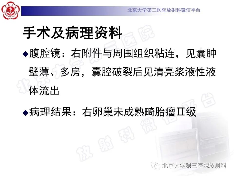 影像PPT - 【PPT】卵巢未成熟畸胎瘤-6