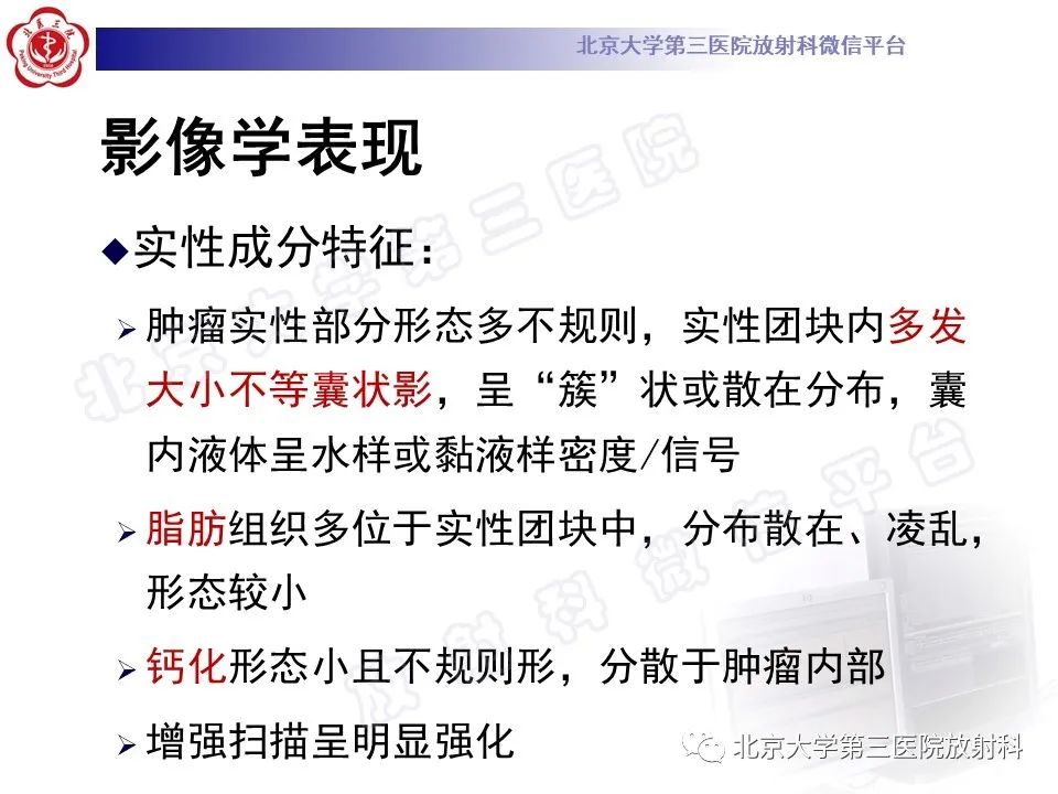影像PPT - 【PPT】卵巢未成熟畸胎瘤-14