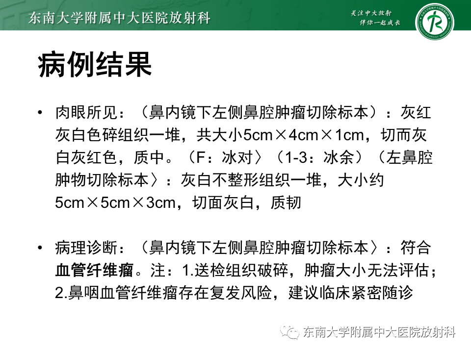 影像PPT - 【PPT】鼻咽纤维血管瘤-5 影像PPT - 【PPT】鼻咽纤维血管瘤-5