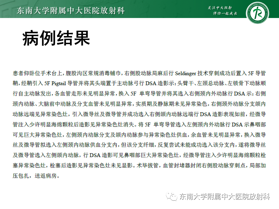 影像PPT - 【PPT】鼻咽纤维血管瘤-4 影像PPT - 【PPT】鼻咽纤维血管瘤-4