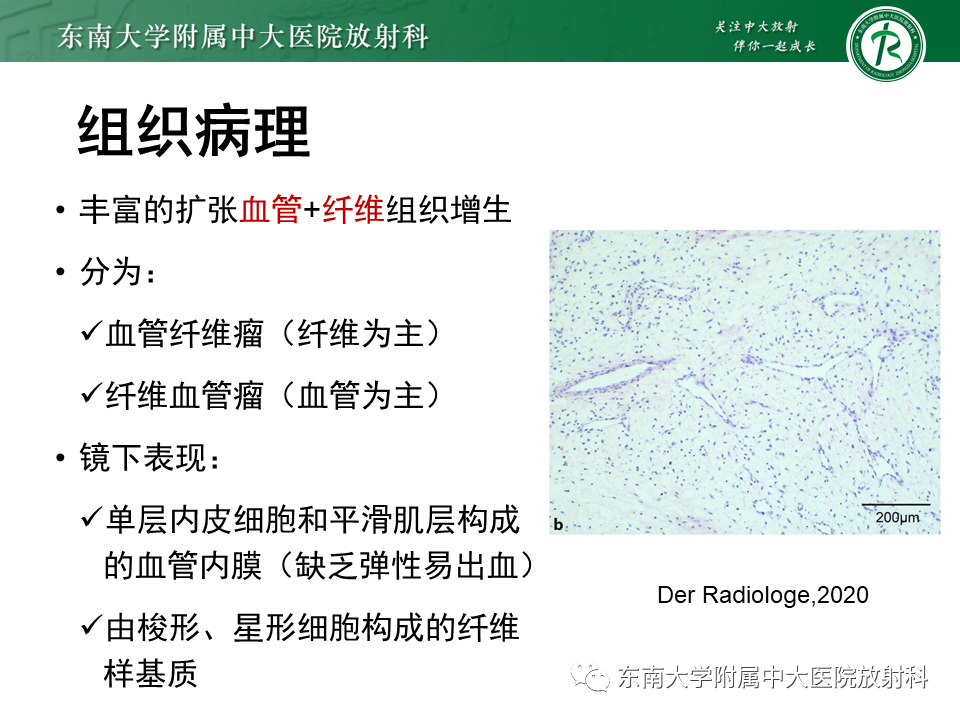 影像PPT - 【PPT】鼻咽纤维血管瘤-9 影像PPT - 【PPT】鼻咽纤维血管瘤-9