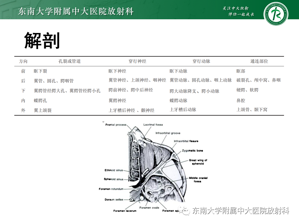 影像PPT - 【PPT】鼻咽纤维血管瘤-13 影像PPT - 【PPT】鼻咽纤维血管瘤-13