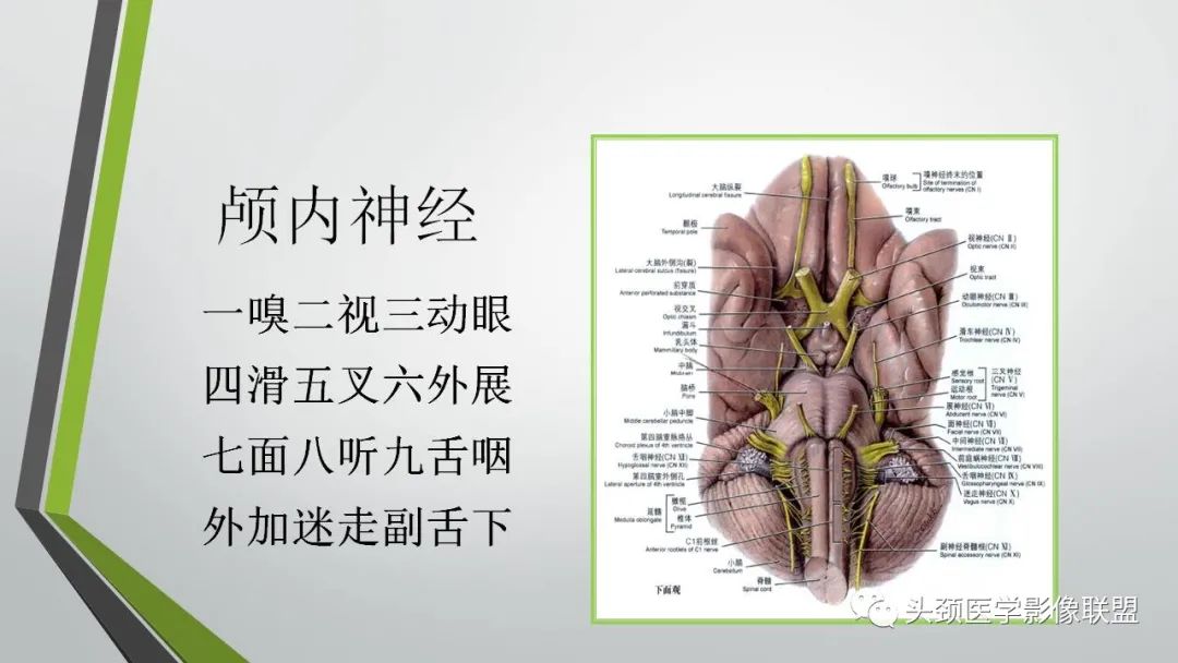 影像PPT - 【PPT】颅内神经影像解剖与病例-2