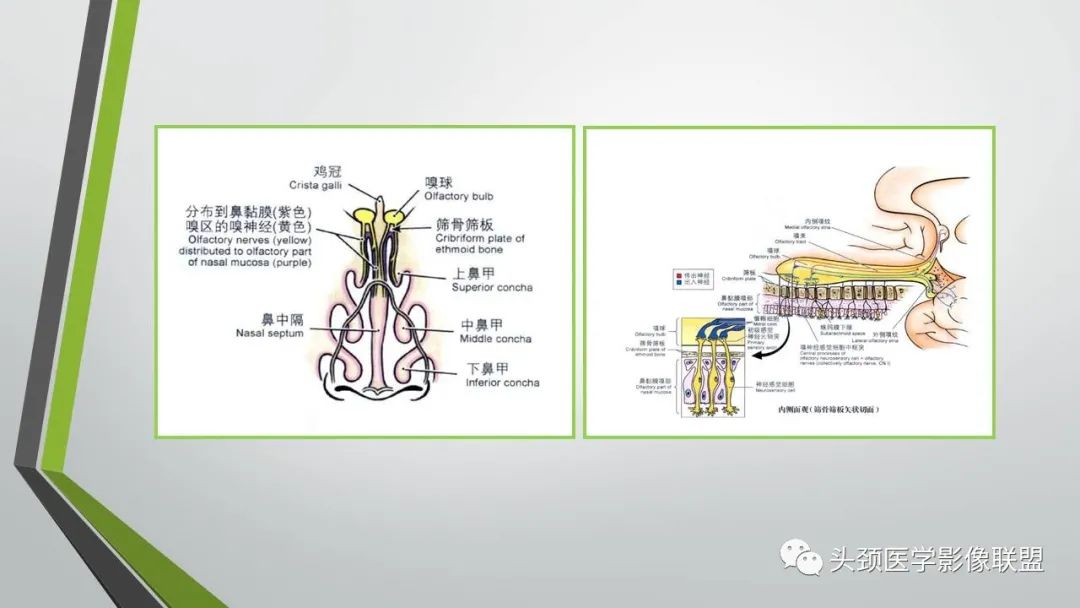 影像PPT - 【PPT】颅内神经影像解剖与病例-9