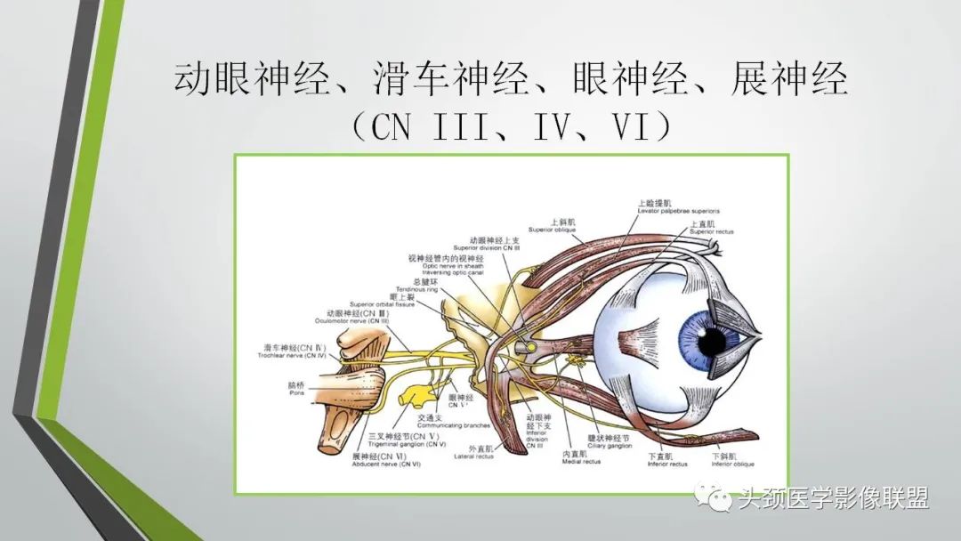 影像PPT - 【PPT】颅内神经影像解剖与病例-26