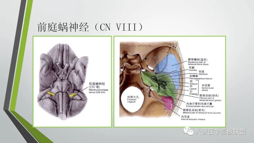 影像PPT - 【PPT】颅内神经影像解剖与病例-58