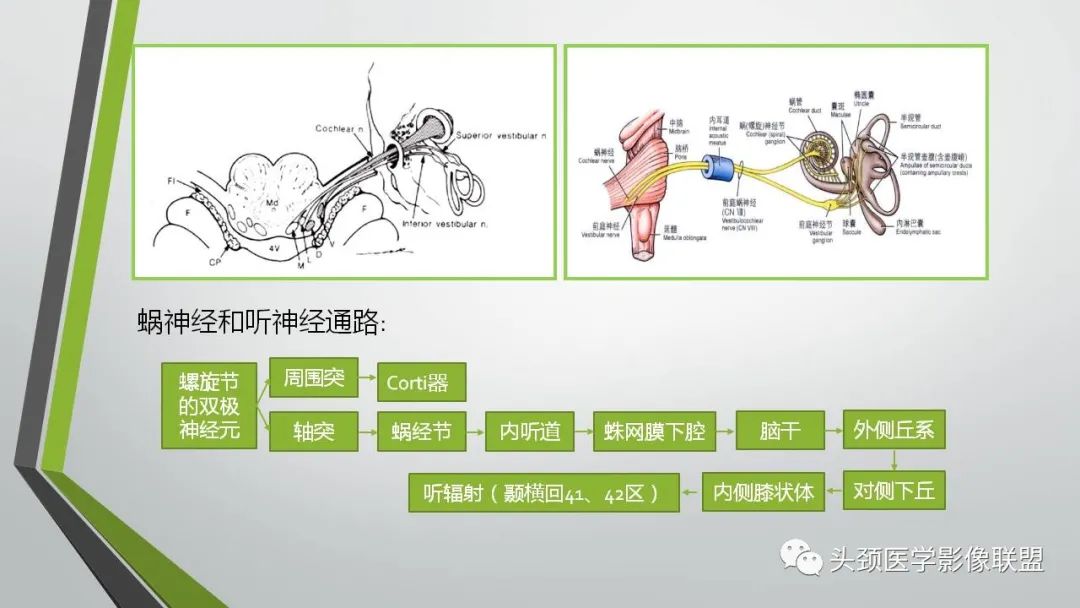 影像PPT - 【PPT】颅内神经影像解剖与病例-60