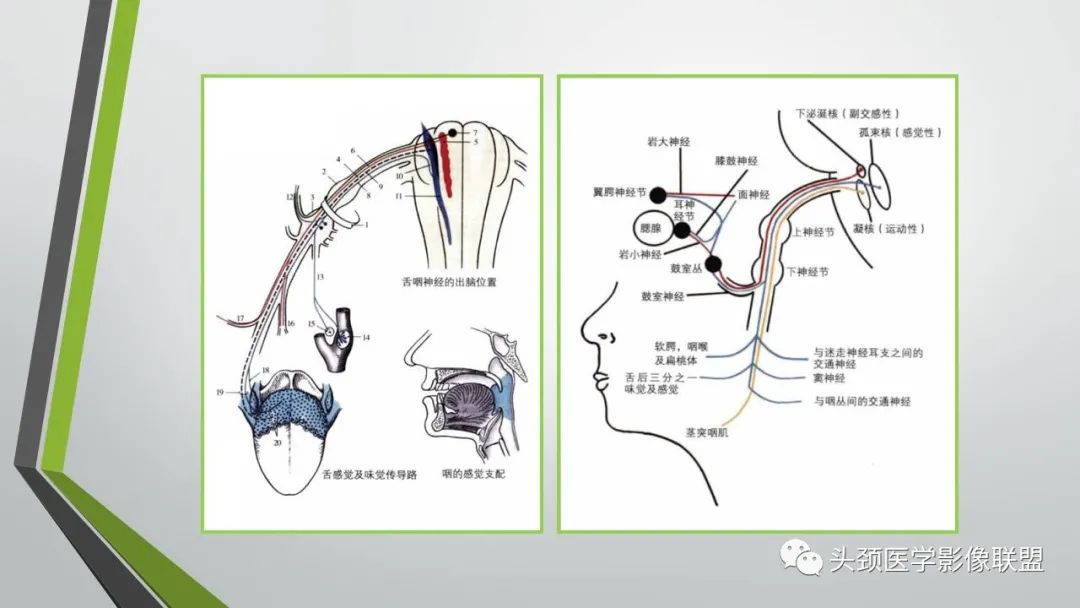 影像PPT - 【PPT】颅内神经影像解剖与病例-73