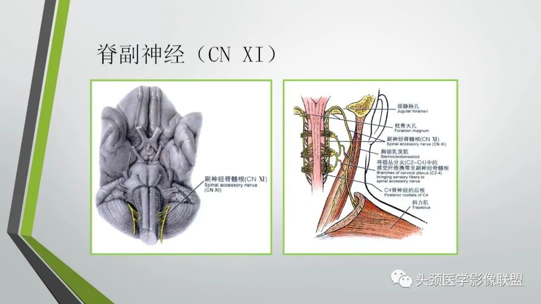 影像PPT - 【PPT】颅内神经影像解剖与病例-85
