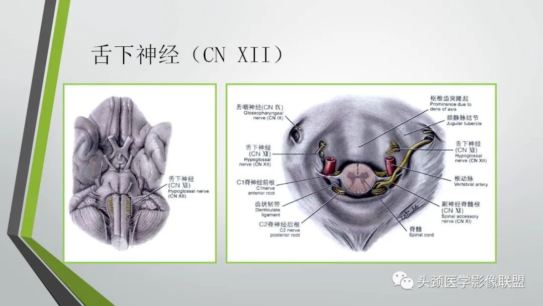 影像PPT - 【PPT】颅内神经影像解剖与病例-89