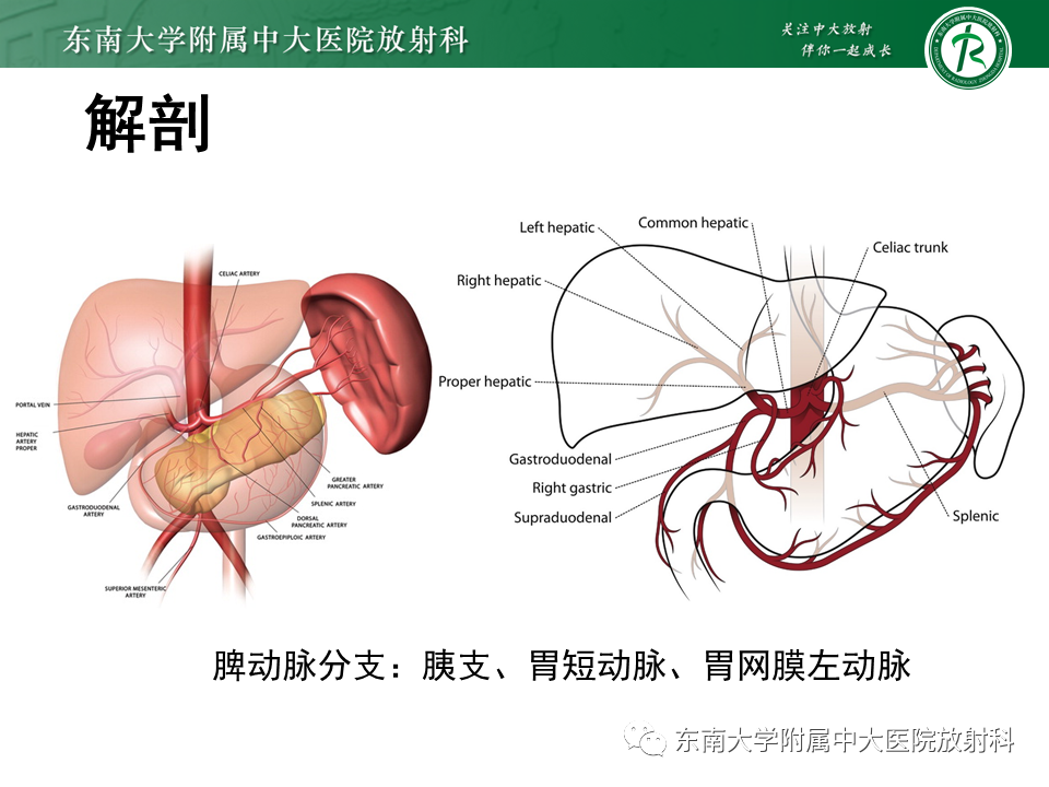 影像PPT - 【PPT】脾动脉瘤-6 影像PPT - 【PPT】脾动脉瘤-6