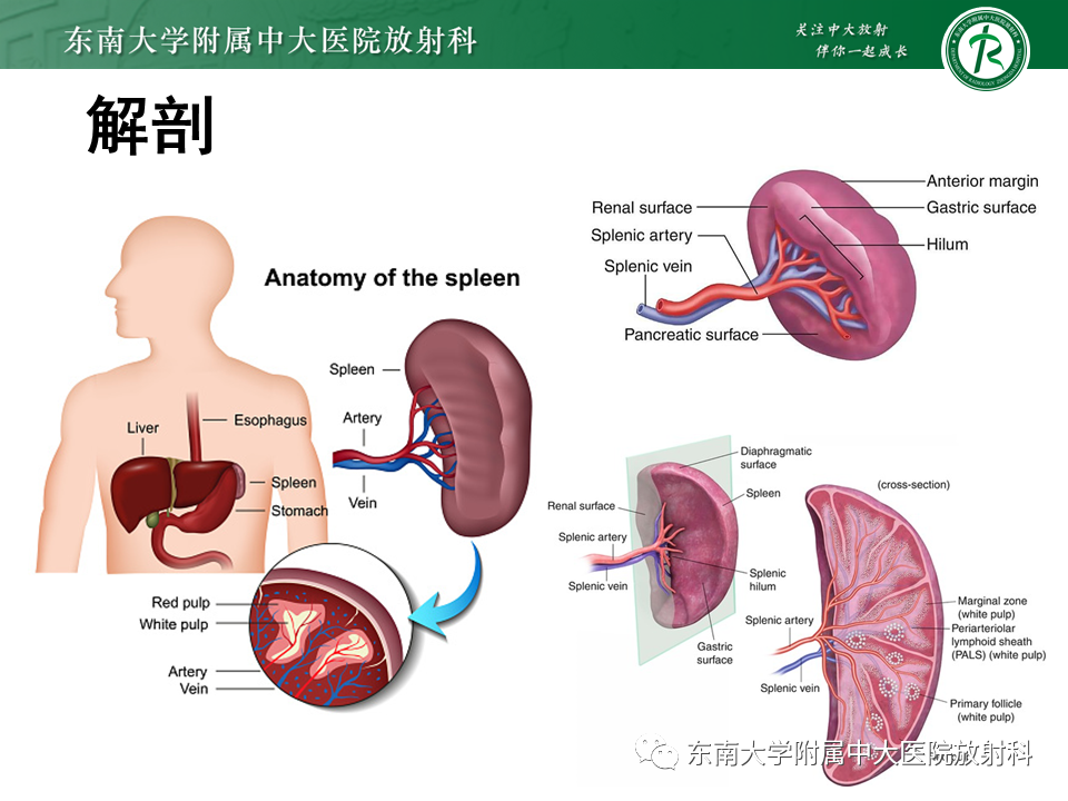 影像PPT - 【PPT】脾动脉瘤-5 影像PPT - 【PPT】脾动脉瘤-5