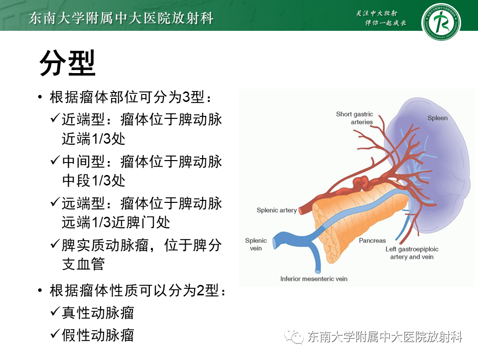 影像PPT - 【PPT】脾动脉瘤-9 影像PPT - 【PPT】脾动脉瘤-9