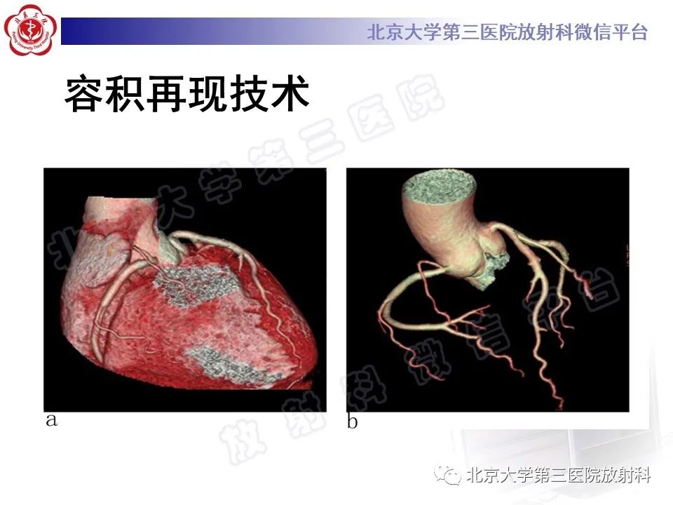 影像PPT - 【PPT】冠状动脉CT血管成像的适用标准及诊断报告书写规范-18
