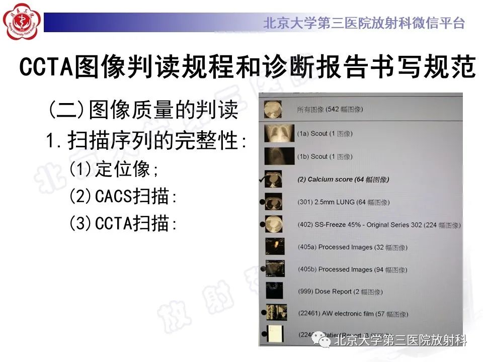 影像PPT - 【PPT】冠状动脉CT血管成像的适用标准及诊断报告书写规范-16