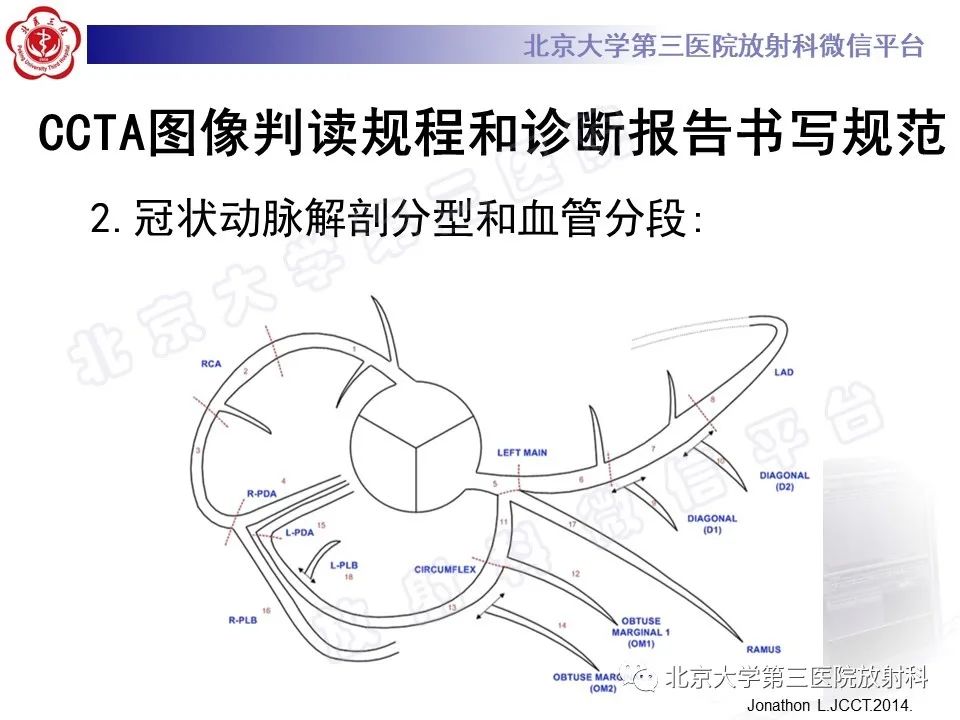 影像PPT - 【PPT】冠状动脉CT血管成像的适用标准及诊断报告书写规范-28