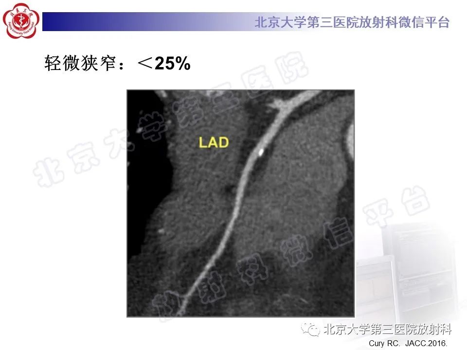 影像PPT - 【PPT】冠状动脉CT血管成像的适用标准及诊断报告书写规范-32