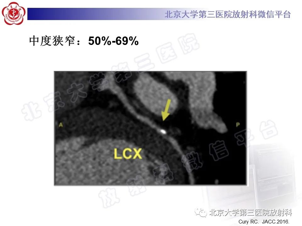 影像PPT - 【PPT】冠状动脉CT血管成像的适用标准及诊断报告书写规范-34