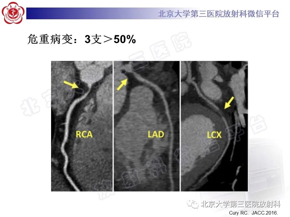 影像PPT - 【PPT】冠状动脉CT血管成像的适用标准及诊断报告书写规范-37