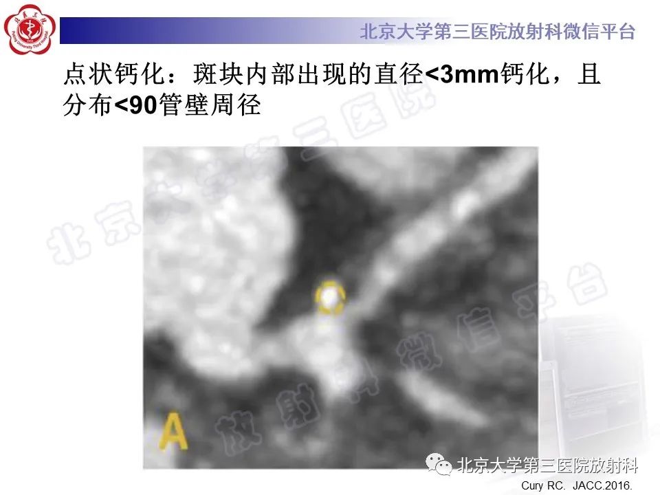 影像PPT - 【PPT】冠状动脉CT血管成像的适用标准及诊断报告书写规范-41