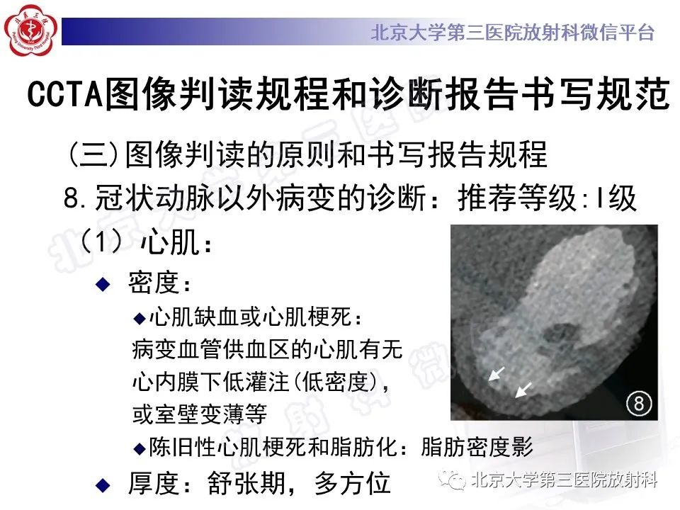 影像PPT - 【PPT】冠状动脉CT血管成像的适用标准及诊断报告书写规范-51