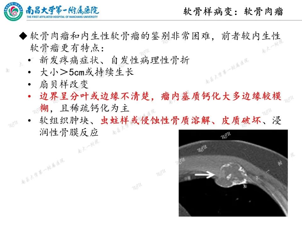 影像PPT - 【PPT】非创伤性肋骨病变及影像诊断思路-24