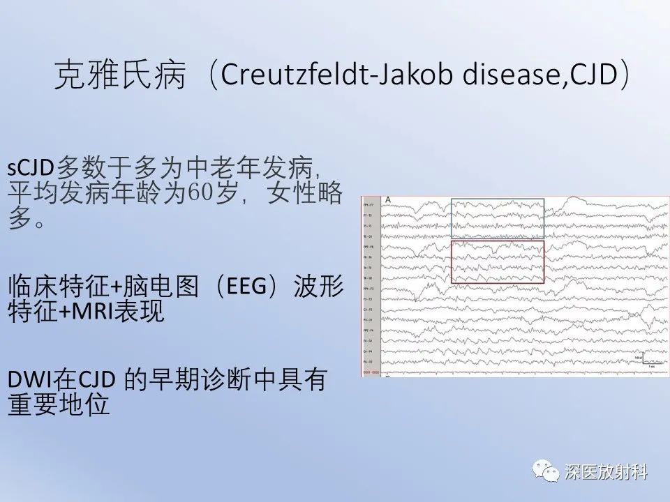 影像PPT - 【病例】克雅氏病1例MR影像诊断-9