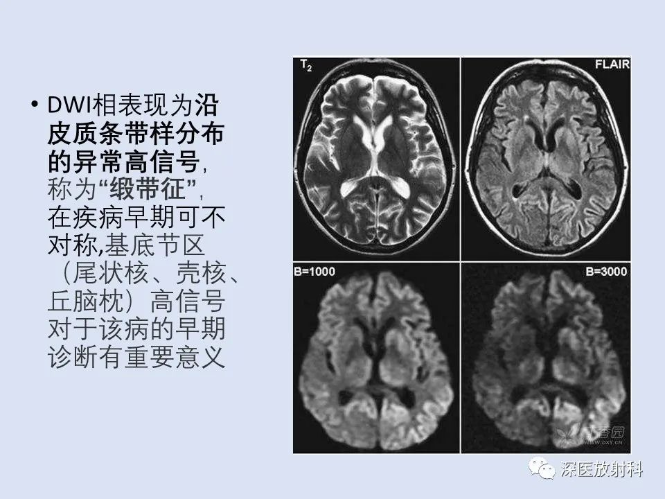 影像PPT - 【病例】克雅氏病1例MR影像诊断-11