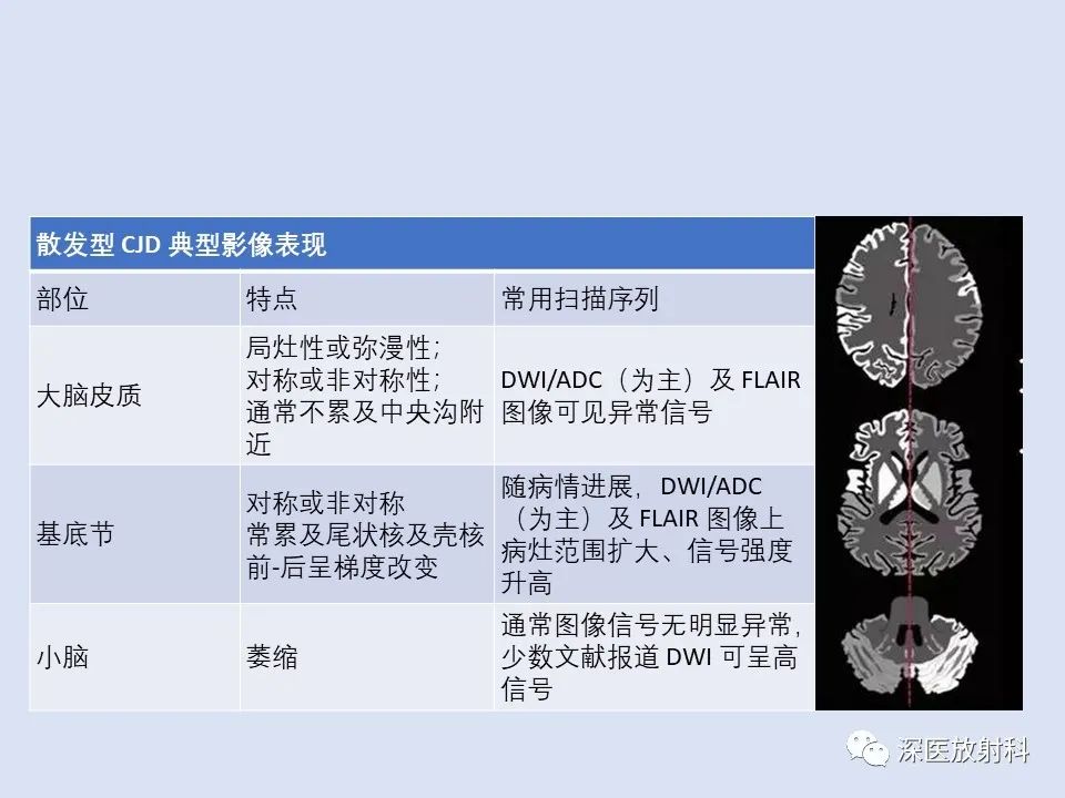 影像PPT - 【病例】克雅氏病1例MR影像诊断-13