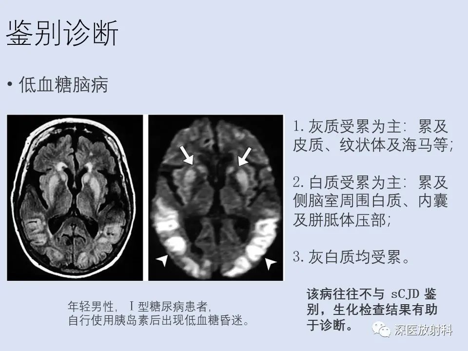 影像PPT - 【病例】克雅氏病1例MR影像诊断-16