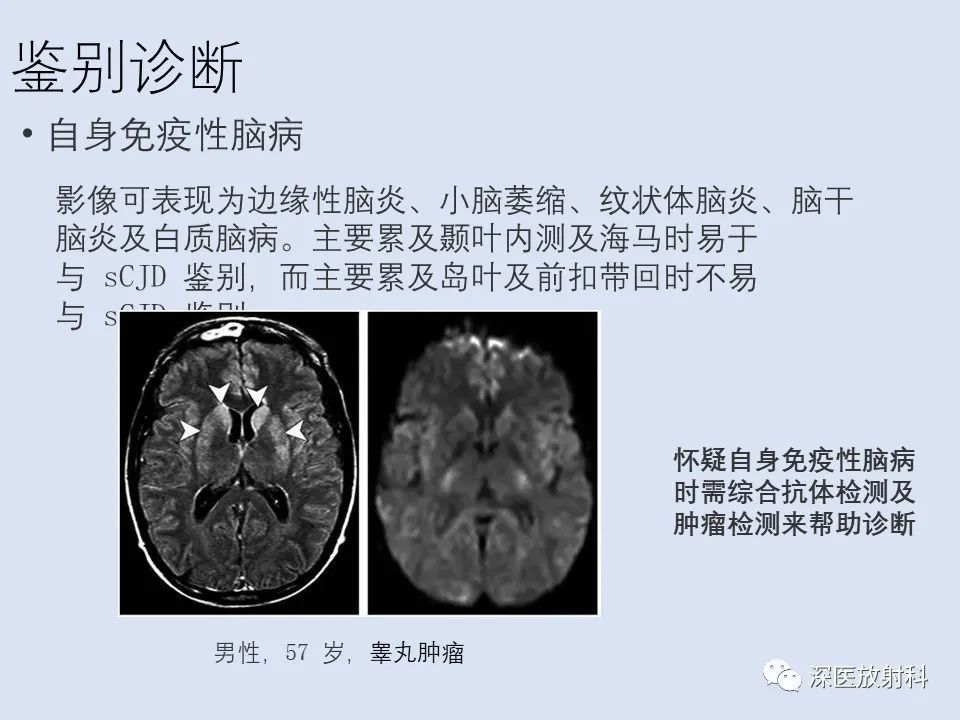 影像PPT - 【病例】克雅氏病1例MR影像诊断-17